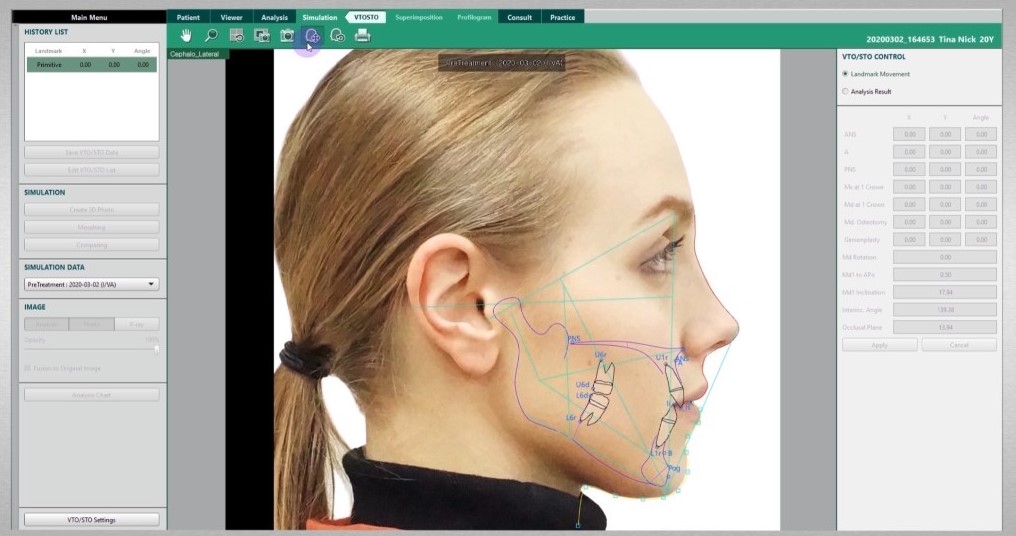 Logiciel d'imagerie EzOrtho | VATECH