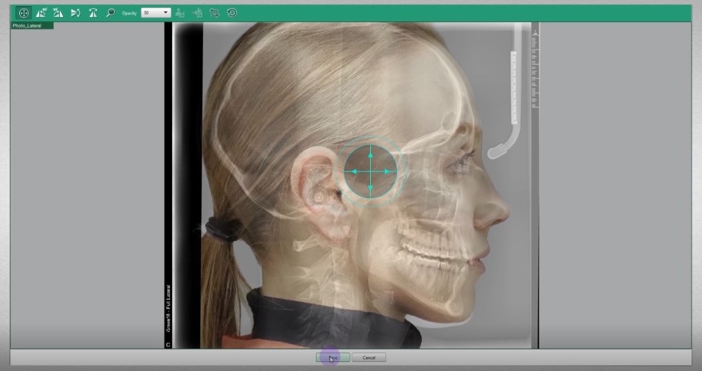 Logiciel d'imagerie EzOrtho | VATECH