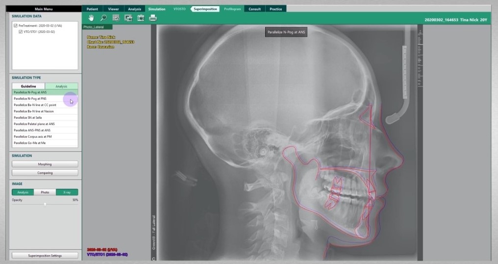 Logiciel d'imagerie EzOrtho | VATECH