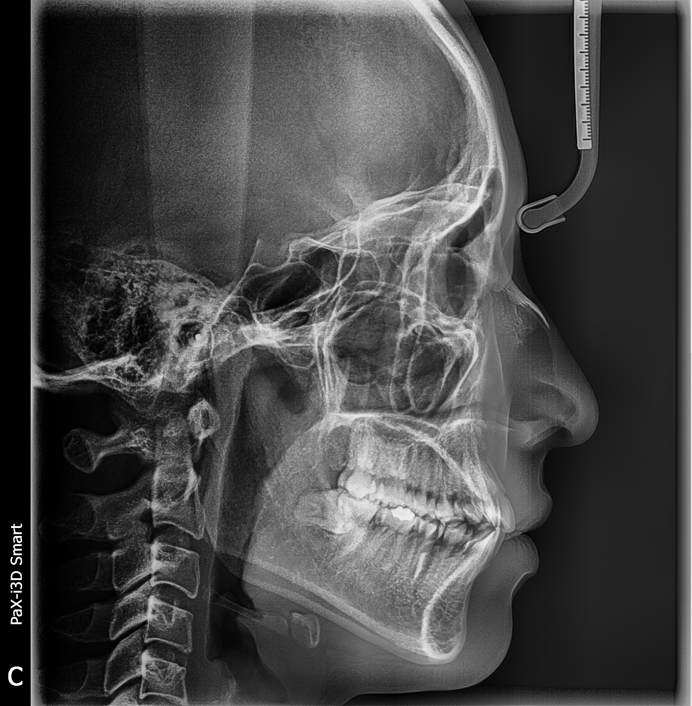 Ortho | VATECH 