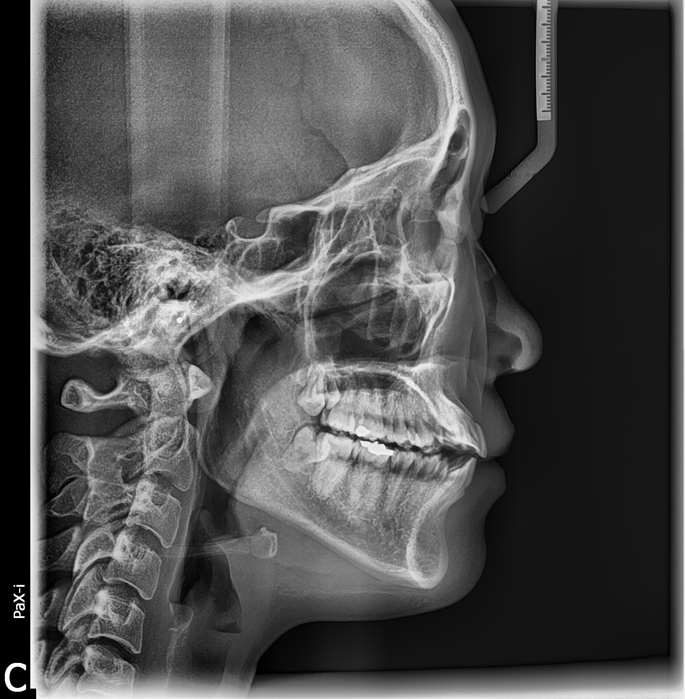 Ortho | VATECH 