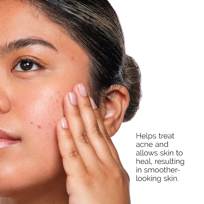 El set para el acné de The Ordinary