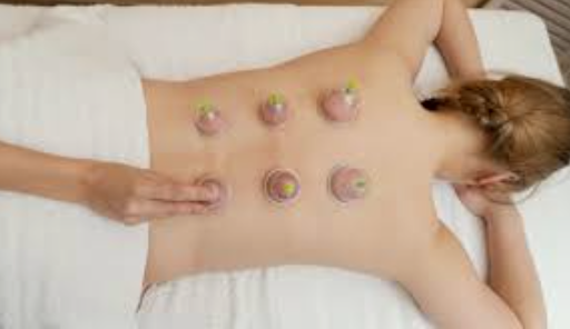 Therapeutic Cupping