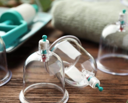 Therapeutic Cupping