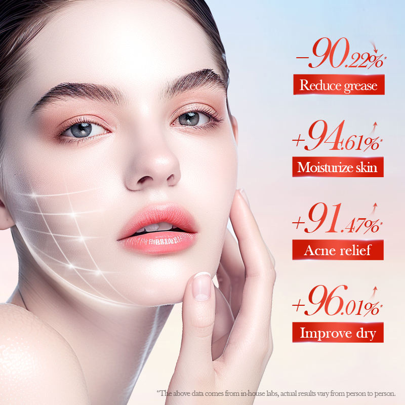 SADOER Acne Relief Lighten Marks Serum