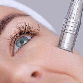 Facial de Limpieza Profunda + Microdermoabrasión