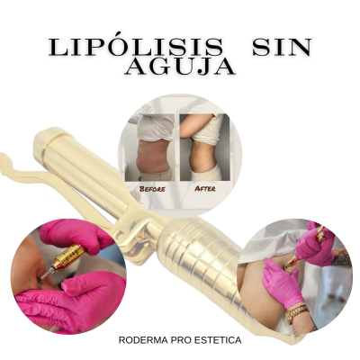 Lipólisis Sin Aguja