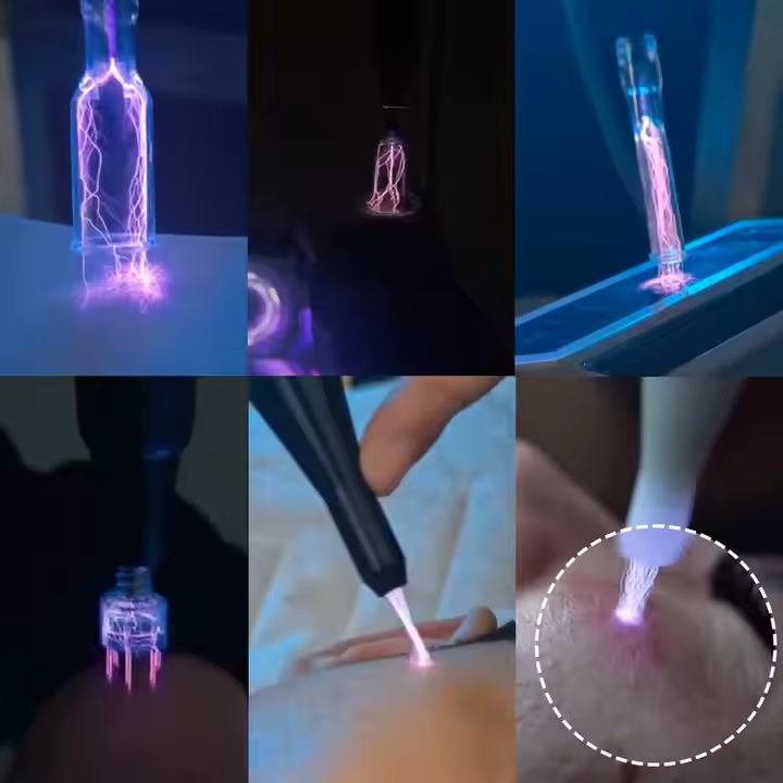 Plasma Pen