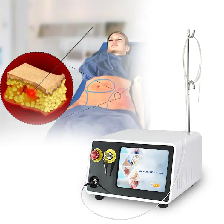 Endolift