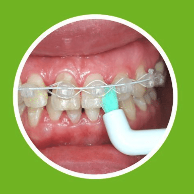 ApaCare Sonic 3D sensitive vieno danties šepetėlio galvutė
