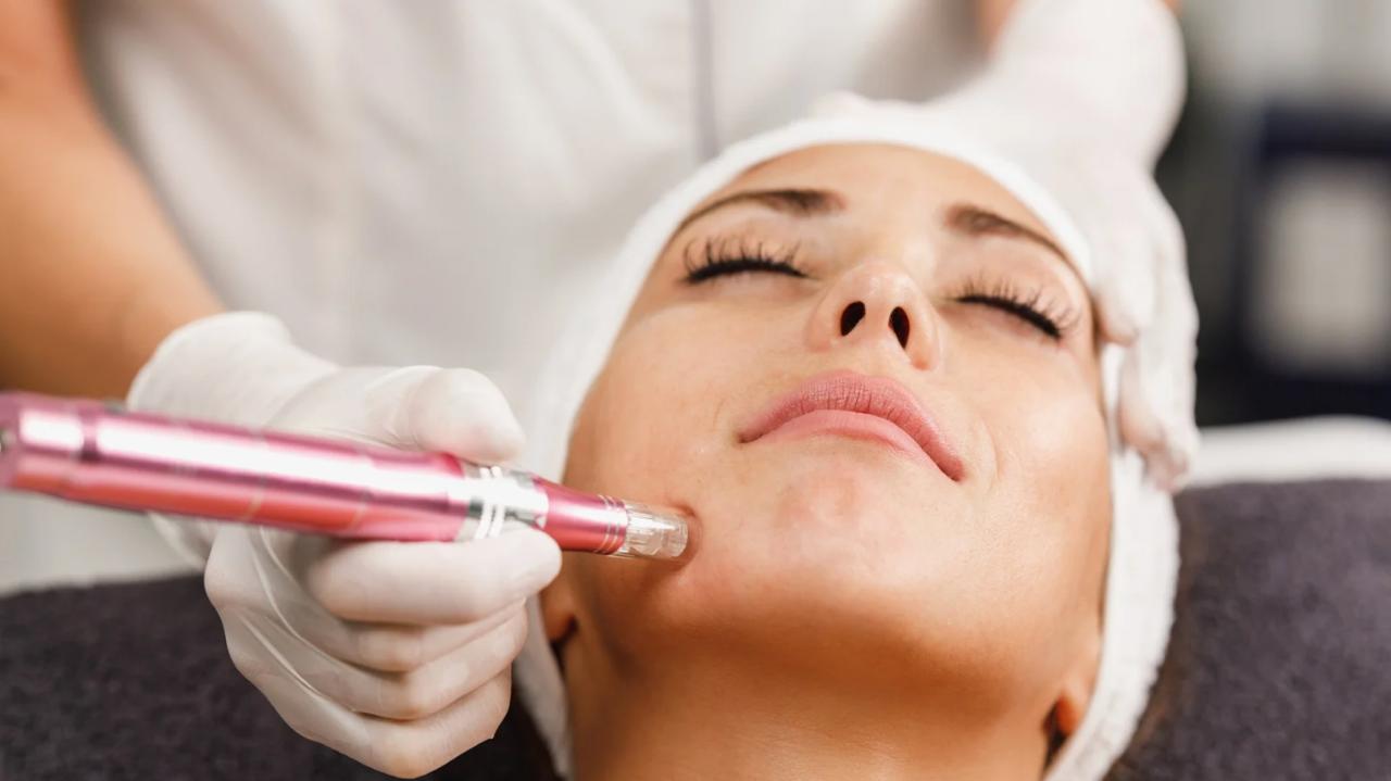 "Microneedling Facial: Rejuvenecimiento Ultra-Preciso para Piel Madura 🪄"