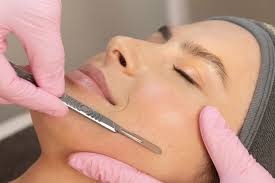 Revitaliza Tu Piel con Nuestro Exclusivo Servicio de Dermaplaning