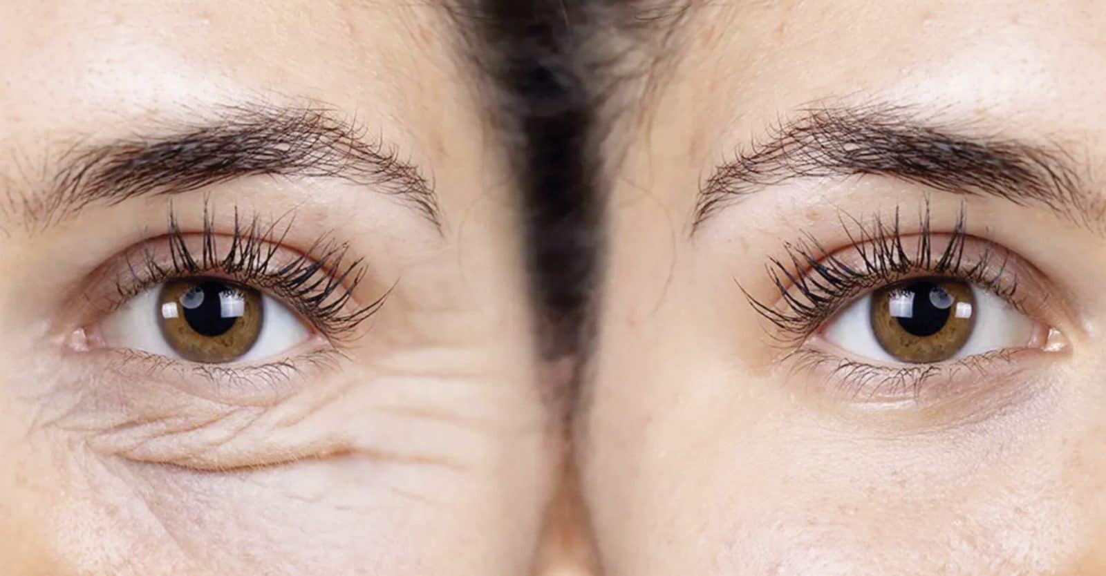 ¡Transforma tu piel con el tratamiento Exosomas!