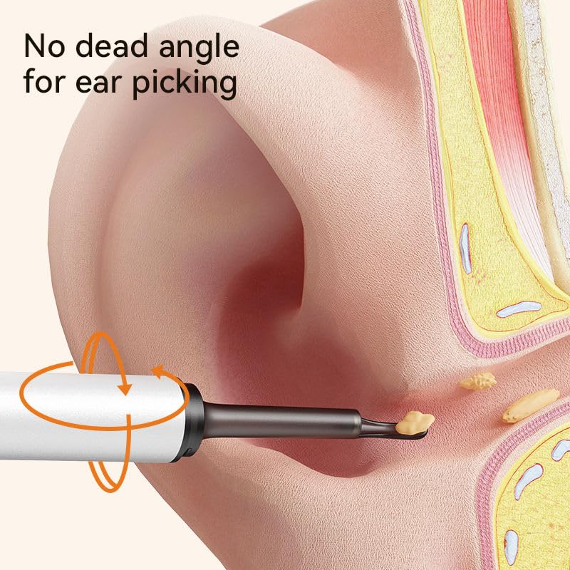 Earwax Removal Tool Kit with HD Camera