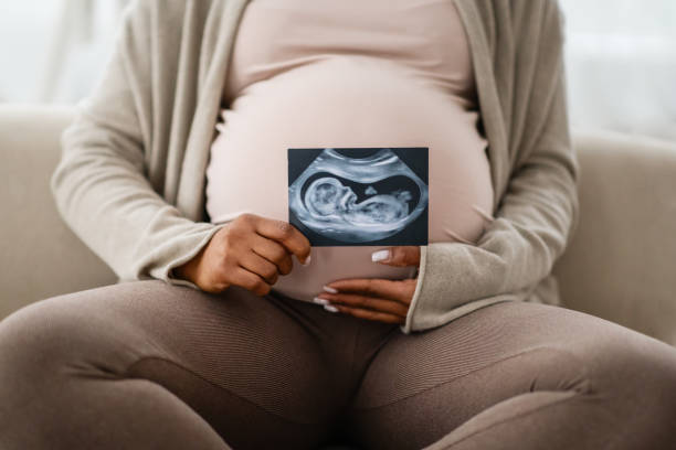 Gender Reveal