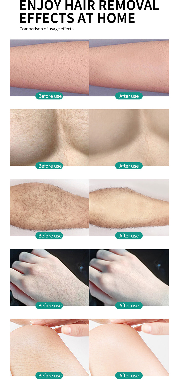 Épilateur Magique en Cristal  Épilation Douce & Zéro Douleur