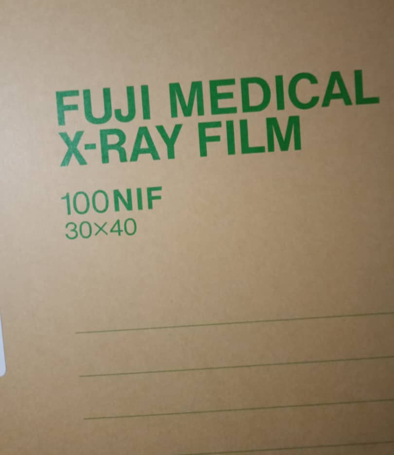  افلام اشعة عادية مقاس 30*40