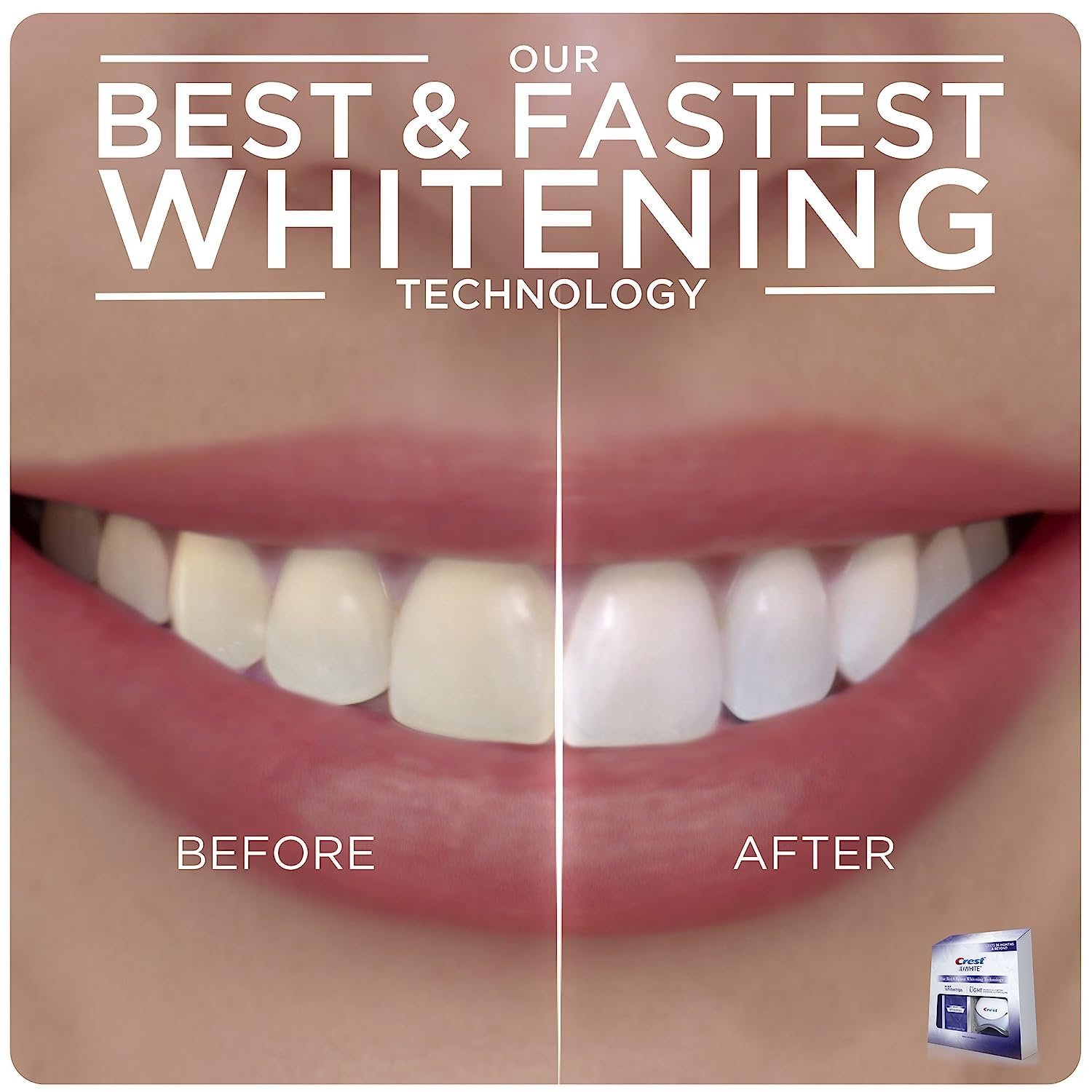  Crest 3D Whitestrips with Light, Whitestrips 3D White, Teeth Whitening Strip Kit, 20 Strips (10 Count Pack), Crest Teeth Whitening Strips, Teeth Whitening Kit