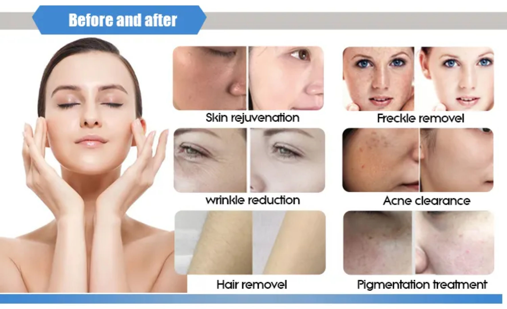 Advanced IPL Laser Hair Removal Machine Skin Rejuvenation Device