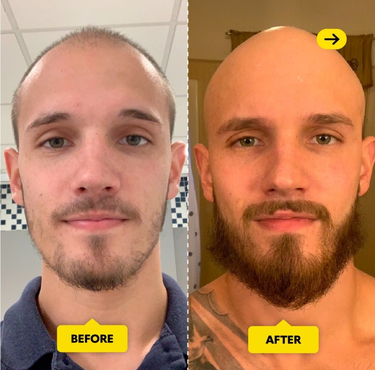 Beard & Hair Growth Serum