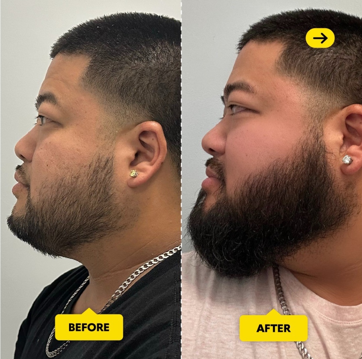 Beard & Hair Growth Serum