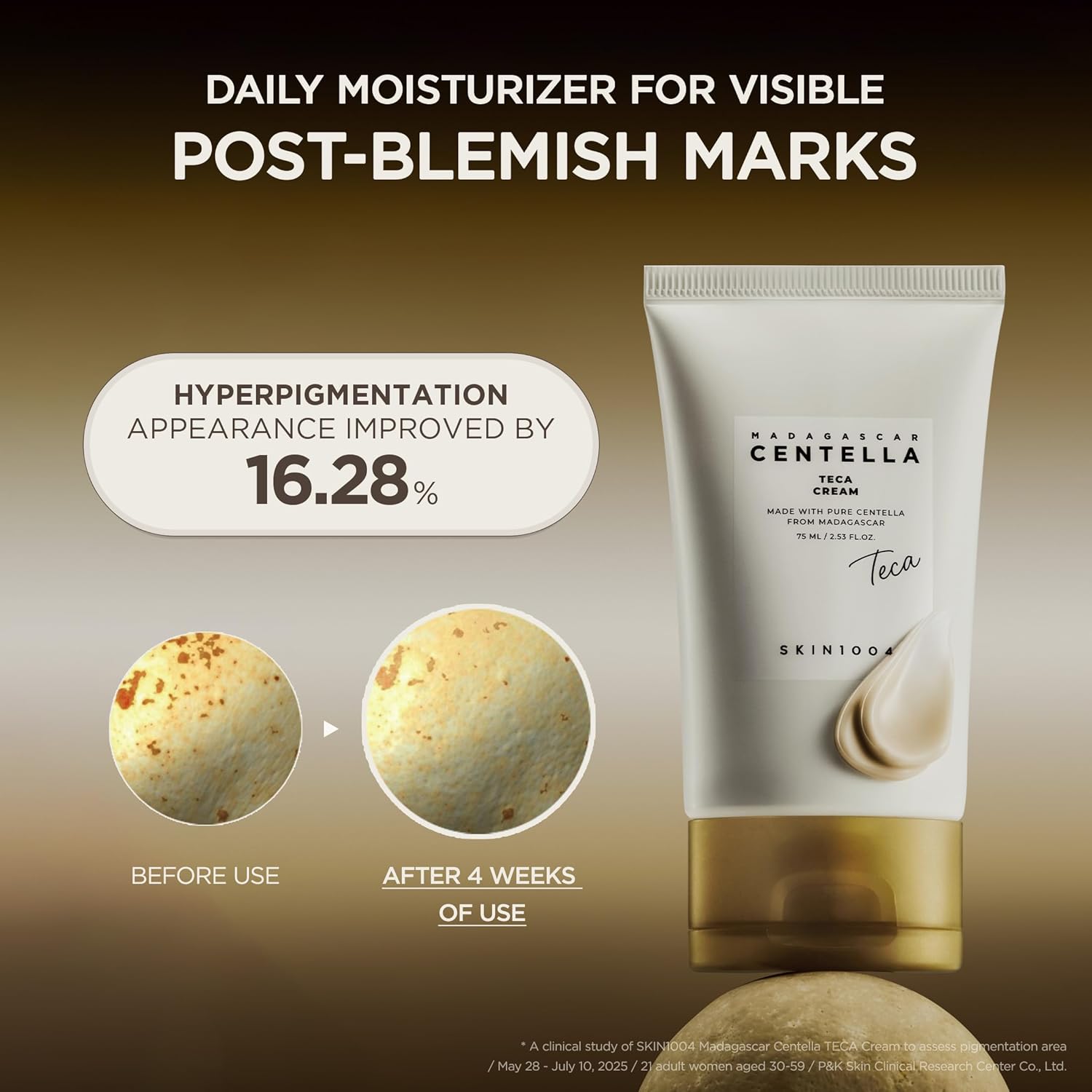 SKIN1004 Madagascar Centella TECA Cream, Face Moisturizer with 50X Centella TECA Technology for Post-Blemish Care & Moisture Barrier, Facial Cream with TECA & PDRN, Korean Skin Care, 2.53 fl oz, 75 ml
