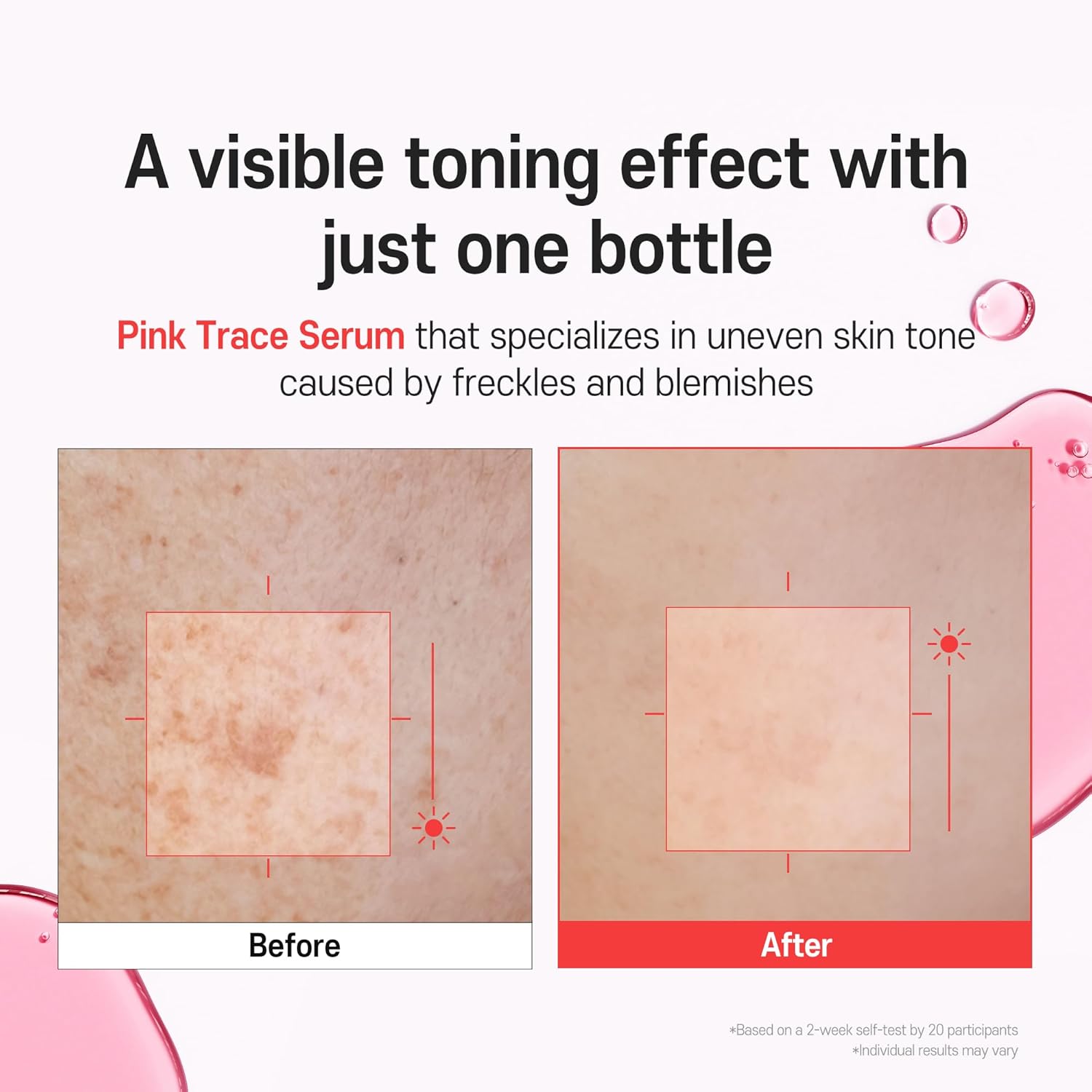 PDRN Serum TXA 5% Niacinamide 10% Pink – Korean Skincare Dark Spot, Hyaluronic Acid, Vitamin B5, Panthenol, Ceramide – Uneven Skin Tone Radiant Complexion, Glass Skin (30ml / 1.01 fl oz)