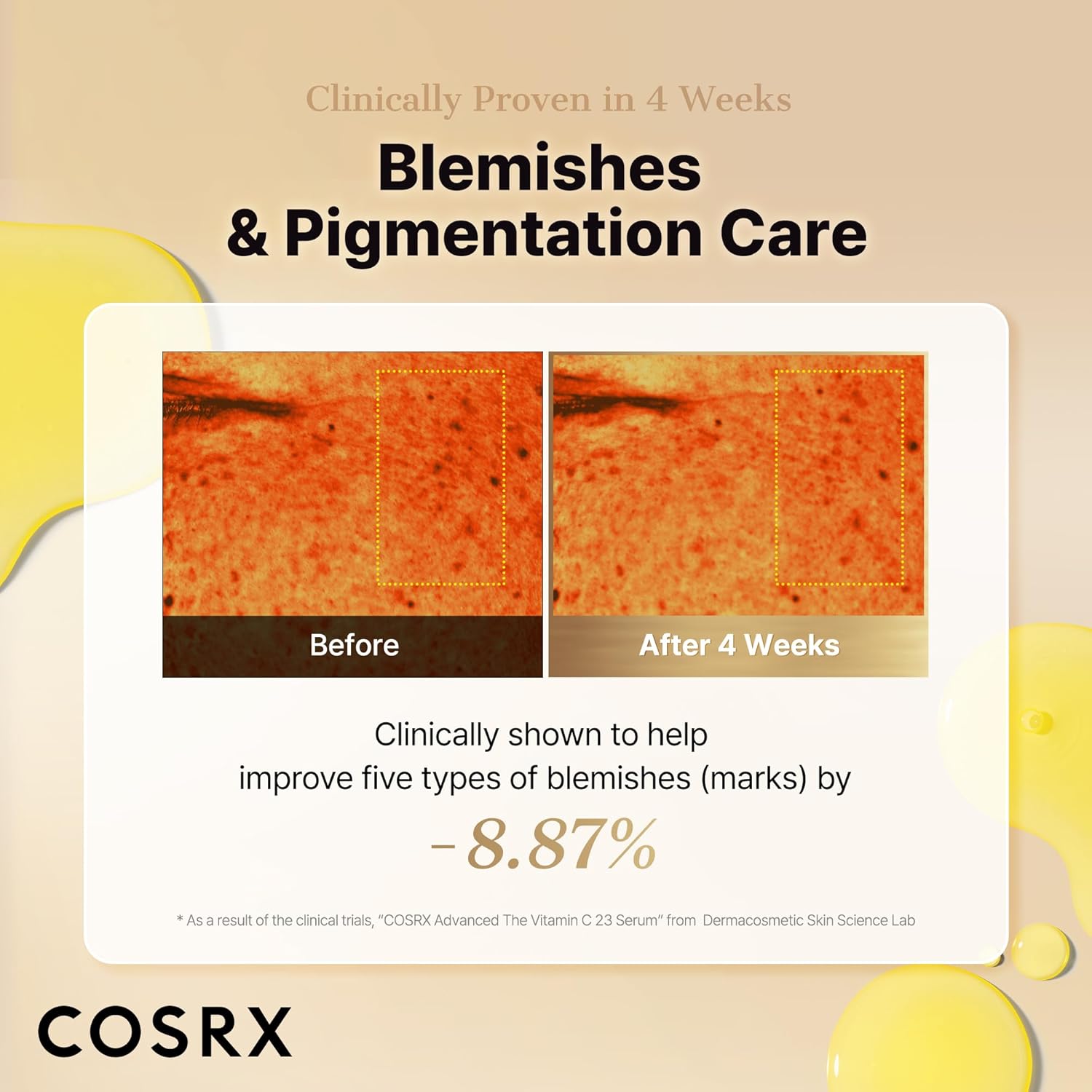 COSRX Advanced Pure Vitamin C 23% Serum with Vitamin E & Glutathione, Korean Vitamin C Serum for Fine Lines, Uneven Skin Tone & Dull Skin, 0.7oz, Korean Skin Care