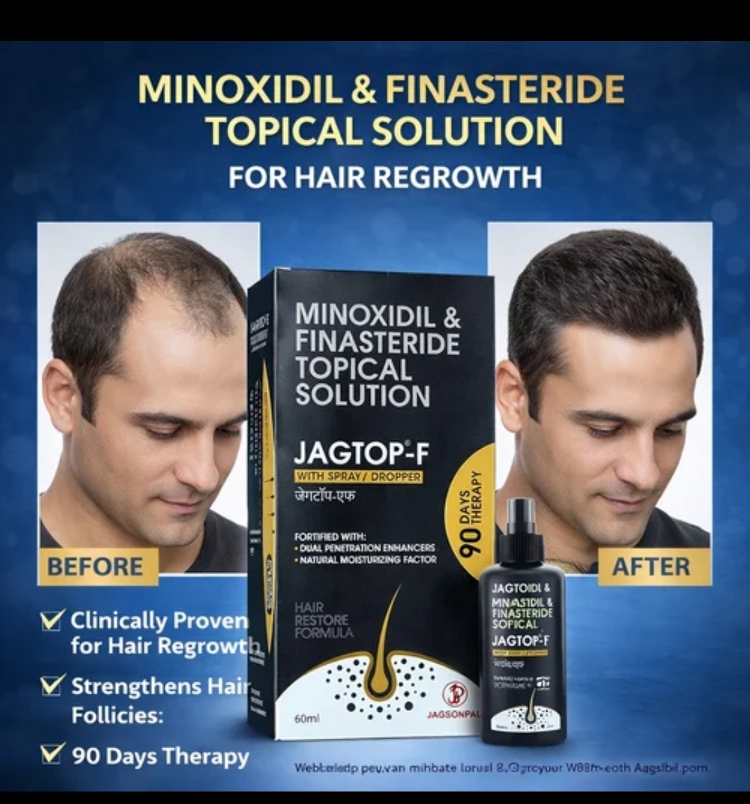 Jagtop F Minoxidil & Finasteride Topical Solution