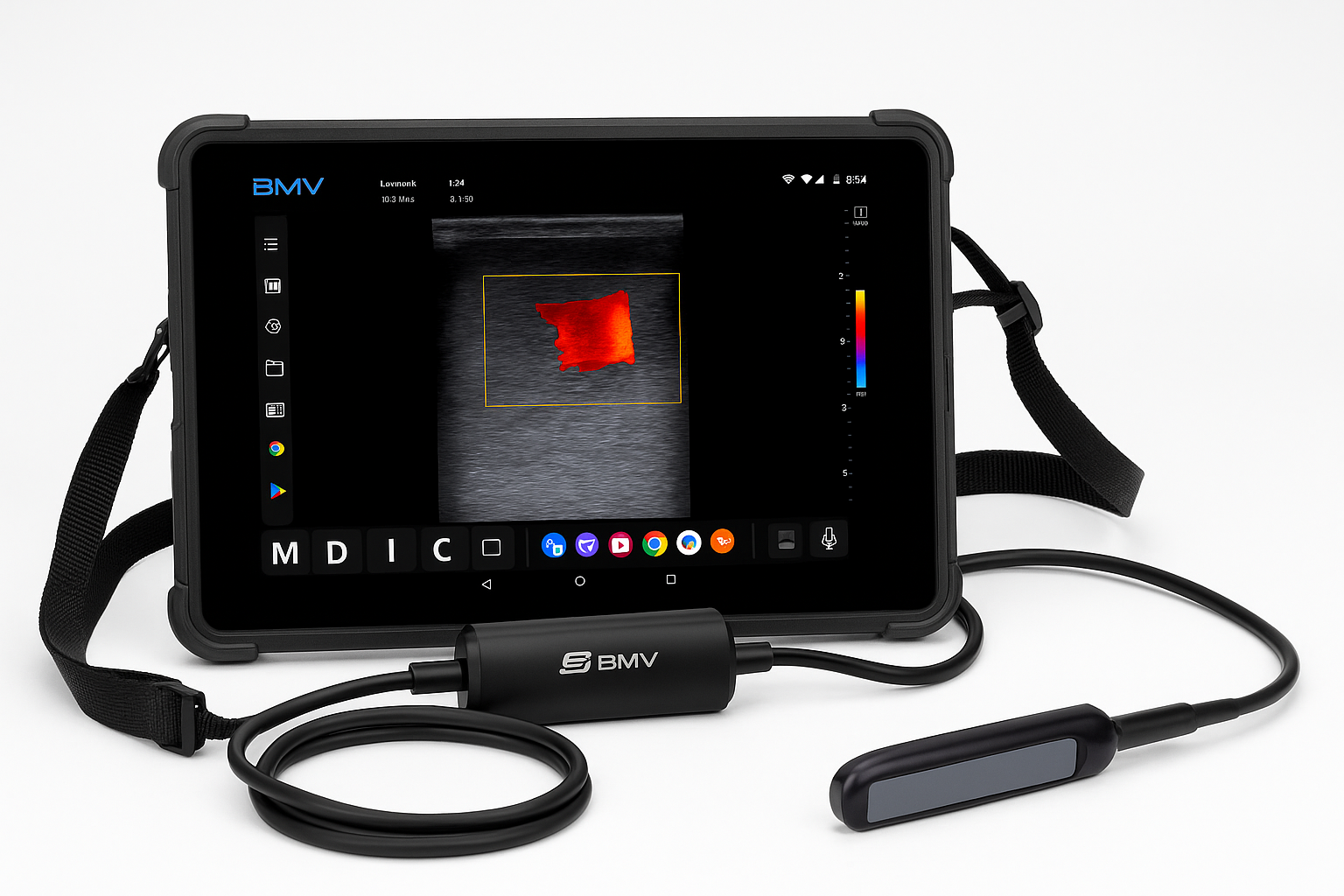BMV MX5 Doppler HD – Échographe Haut de Gamme avec Sonde Linéaire Ultra-Précise