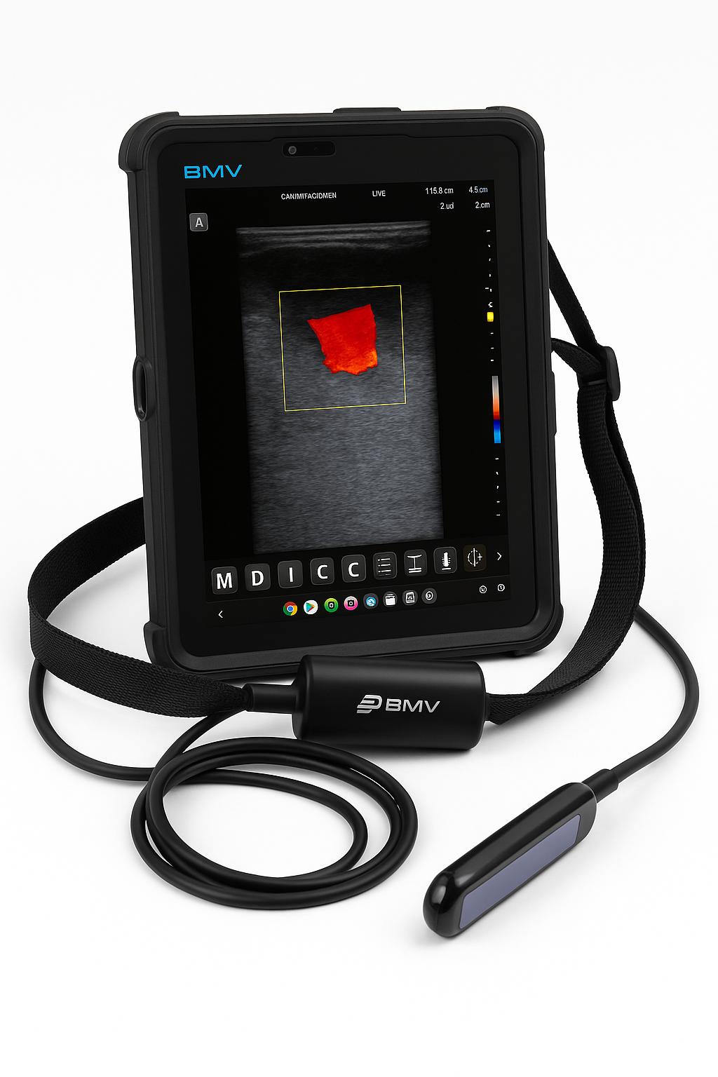 BMV MX5 Doppler HD – Échographe Haut de Gamme avec Sonde Linéaire Ultra-Précise