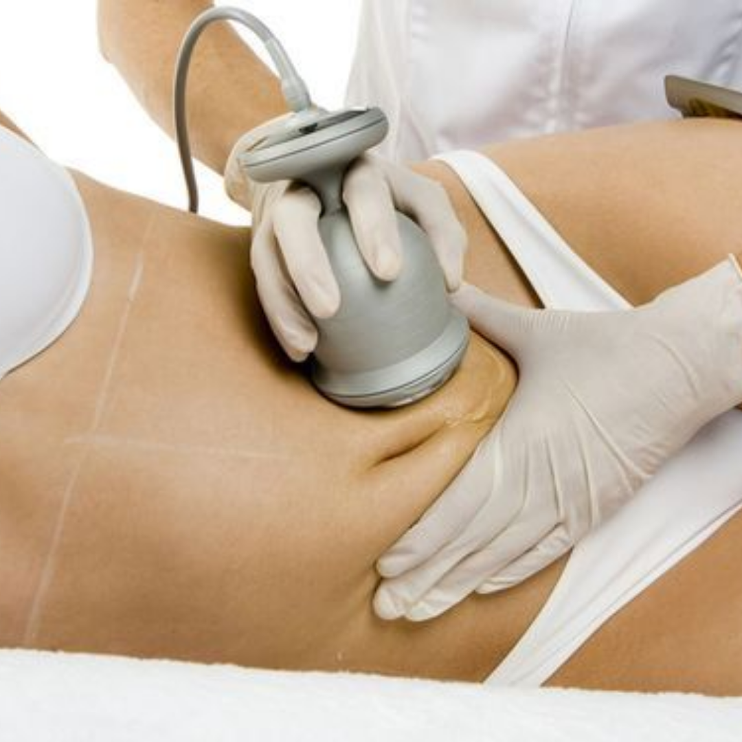 Liporreducción Integral