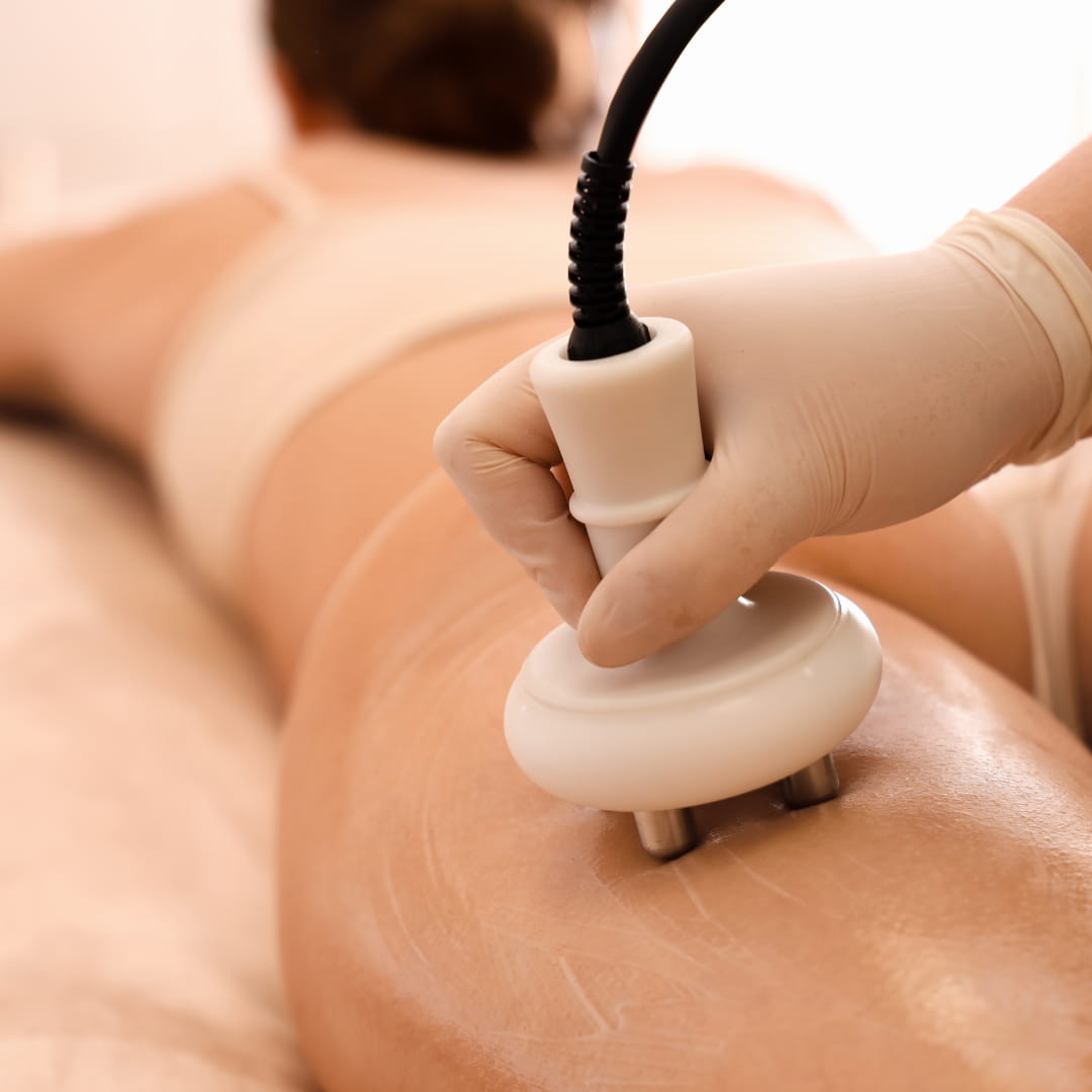 Radiofrecuencia Corporal