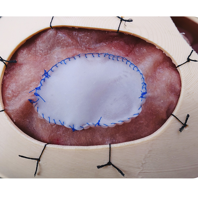 Dural Repair Training Model For Neurosurgery Training