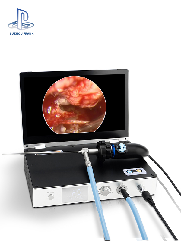 Suzhou Frank 11.6inch Medical Endoscopy Camera System 4 in 1 1080P HD 30W LED Light Source 11.6" Portable Endoscope Camera Medical All in One