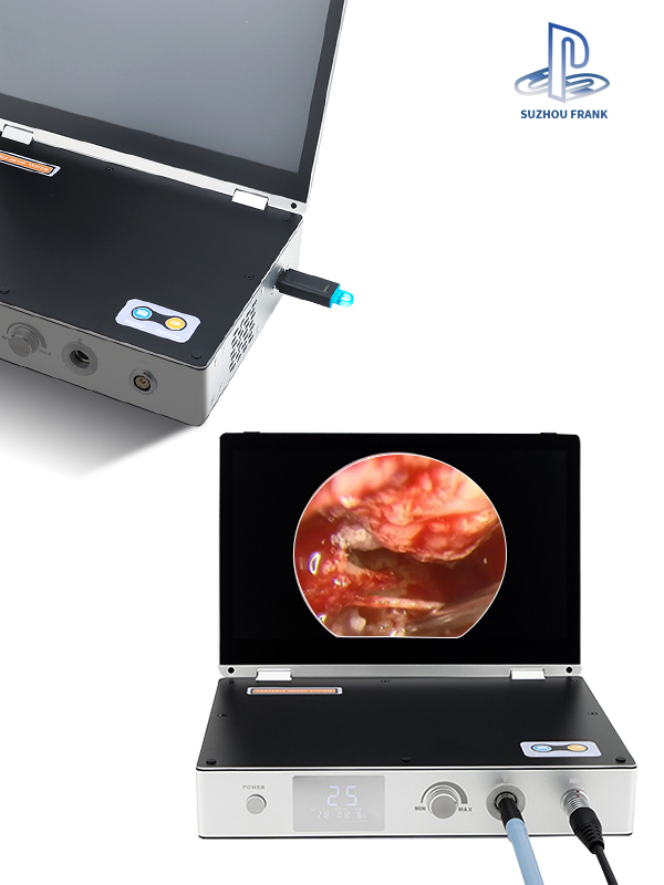 Suzhou Frank 11.6inch Medical Endoscopy Camera System 4 in 1 1080P HD 30W LED Light Source 11.6" Portable Endoscope Camera Medical All in One