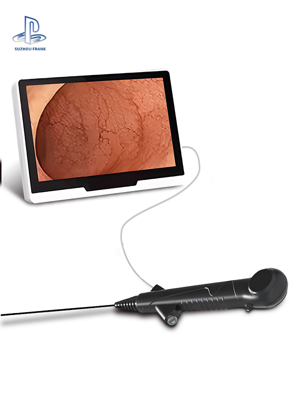 Suzhou Frank Disposable Flexible Animal Diagnosis Equipment Ureteral Therapeutic Equipment for Exploratory Veterinary Therapeutic Equipment
