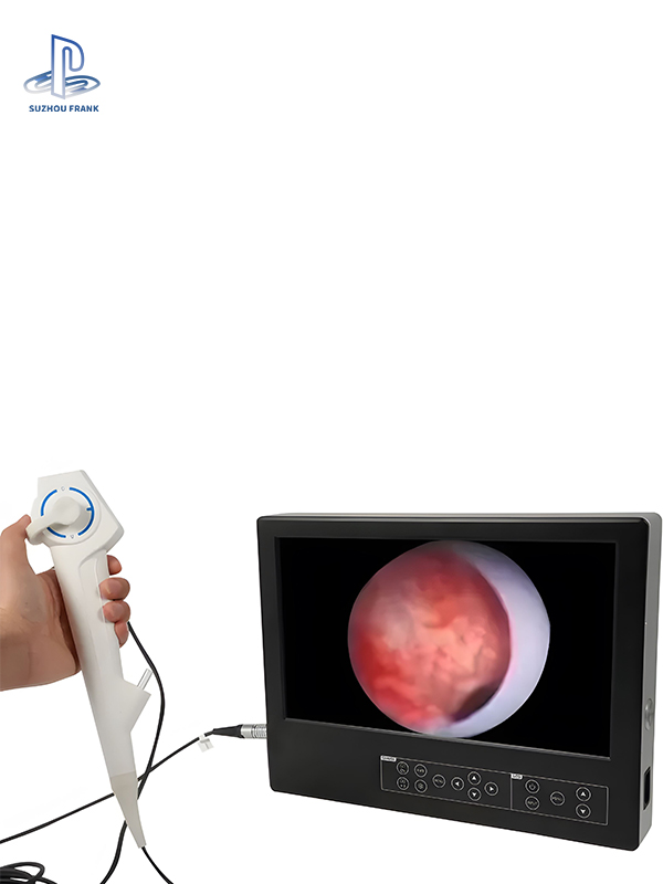 Suzhou Frank Bronchoscope  Surgical Disposable Bronchoscope for Ent Intubation