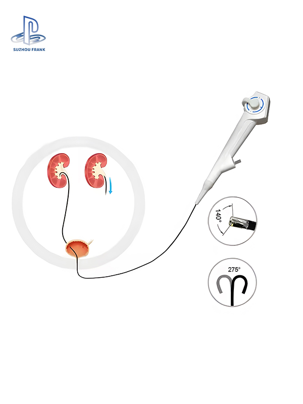 Suzhou Frank Bronchoscope  Surgical Disposable Bronchoscope for Ent Intubation