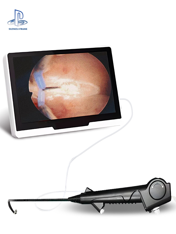 Suzhou Frank Factory Price Flexible Surgery Disposable Electronic Cystoscope OD 4.8mm/5.4mm Disposable Flexible Endoscope