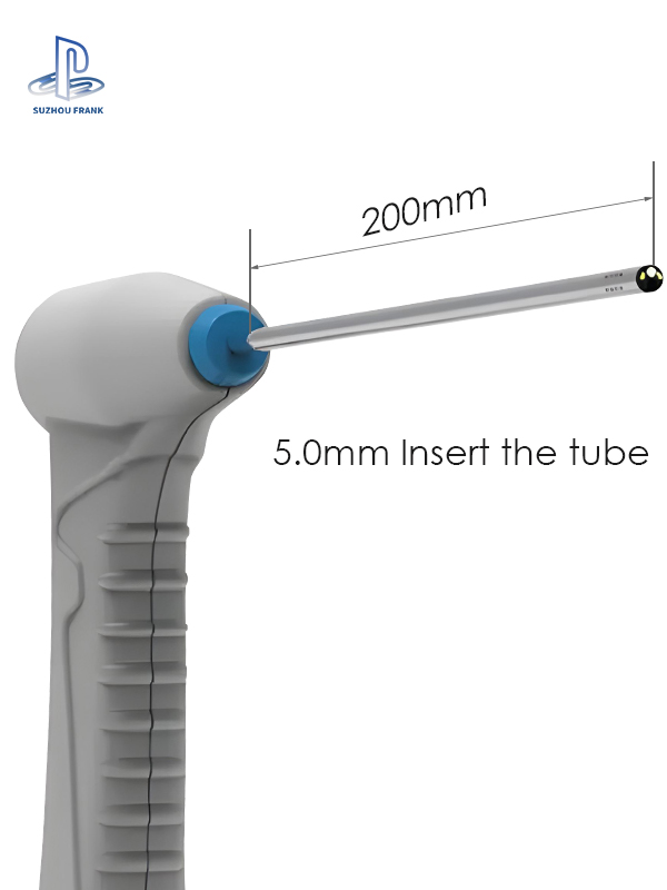 Suzhou Frank 5.0mm Inspection Endoscope Single Use Hysteroscope Disposable Uteroscope Rigid Hysteroscope