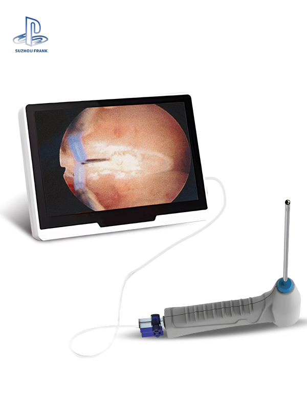 Suzhou Frank 5.0mm Inspection Endoscope Single Use Hysteroscope Disposable Uteroscope Rigid Hysteroscope