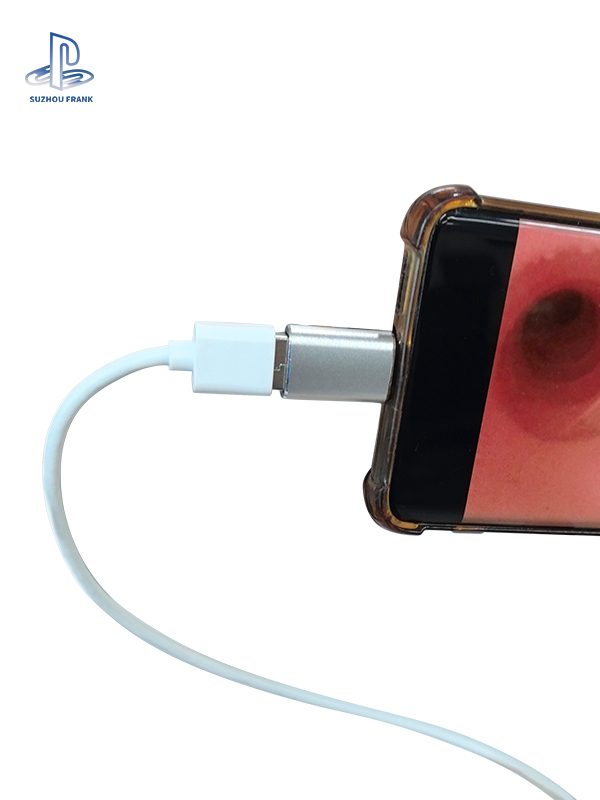 Suzhou Frank High Quality FES-Z002 Easy-to-Operate Endoscope for Pet Veterinary Therapeutic Equipment Disposable Flexible Bronchoscope