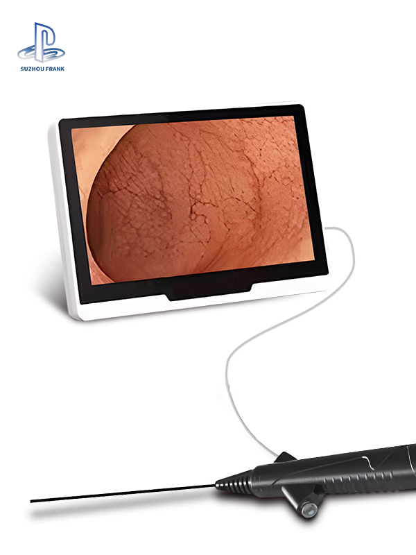 Suzhou Frank Veterinary Instrument for Single Use Animal Ureteral Diagnosis 16K Pixels Pet Health Care Disposable Flexible Endoscope