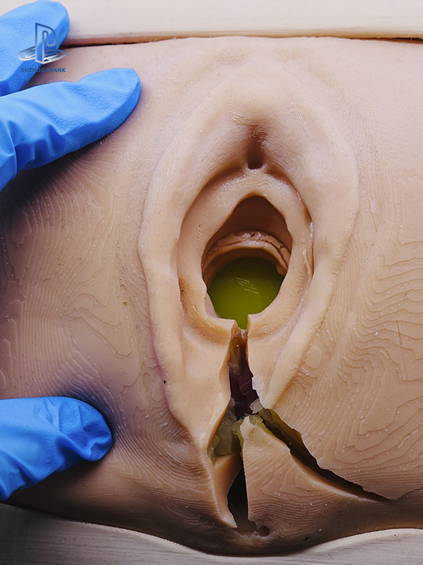 Suzhou Frank Lateral Perineal Vulva Laceration Training Model Simulated Suturing Practice