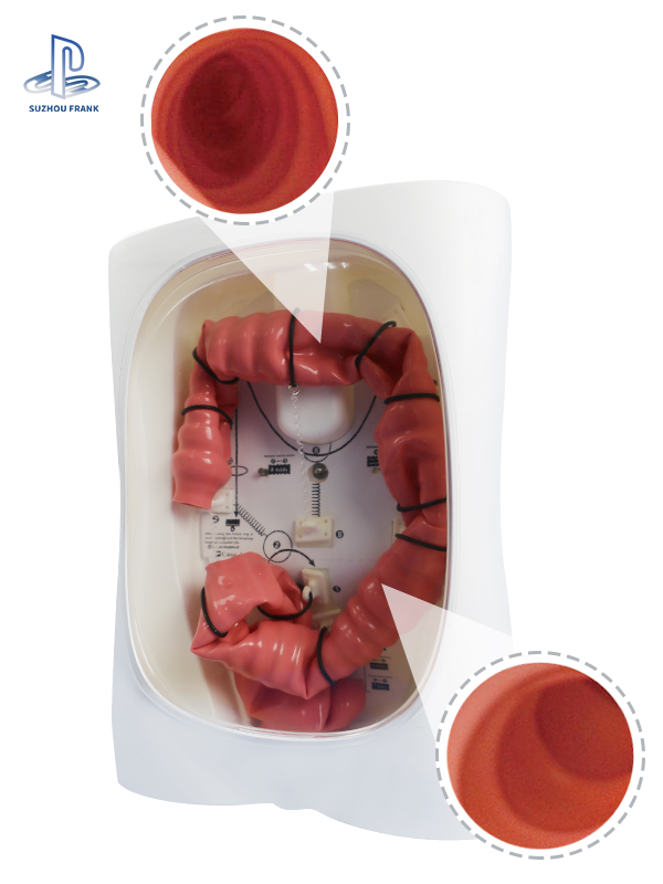 Suzhou Frank Colonoscopy Training Model SLD Silic A Gel Ndoscopies of Anus Four Types of Simulated Polyps