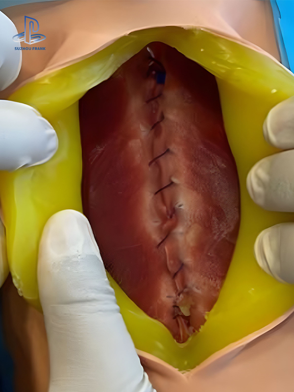 Suzhou Frank Abdominal Wall Suture Training Model Silicone General Surgery Ayer-by Layer Suturing Training