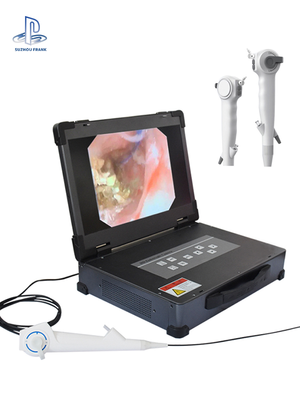Suzhou Frank USB Flexible Digital Video Disposable Single Use Nephroscope Set for Urology Endoscopic