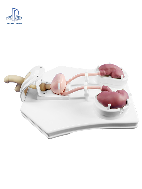 Suzhou Frank  Urological Endoscopy Training Model Polymer Simulation Kidney Ureters Bladder Sexual organs  Reusable Kidney Polyps