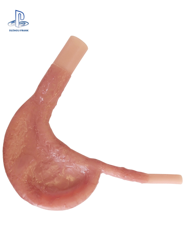 Suzhou Fank Gastrointestinal Anastomosis Model Gastroenterology Silicone  sSimulating the Texture Surgery Training Model